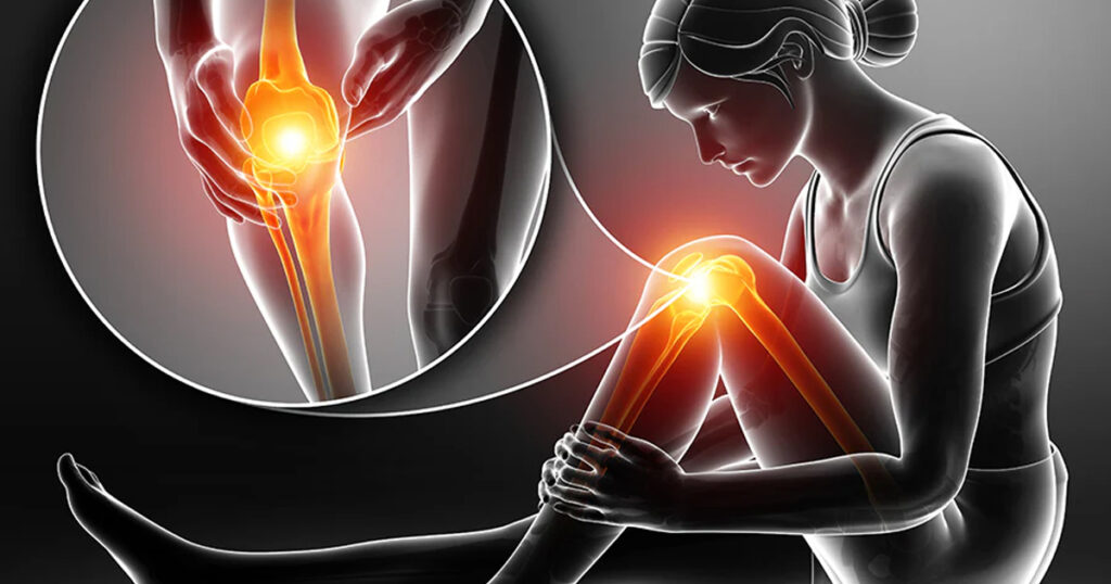 Causes-of-Knee-Pain-in-Ladies-1024x538 Understanding Knee Pain: Causes, Symptoms, and Effective Treatments for Lasting Relief